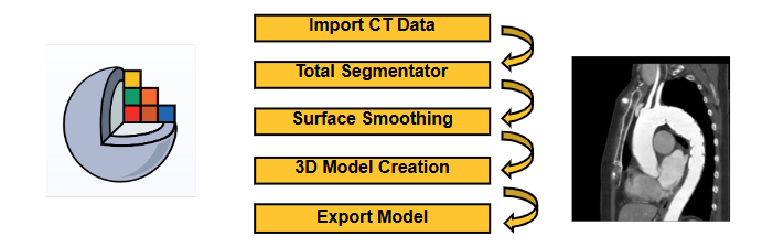 aorta reconstruction workflow