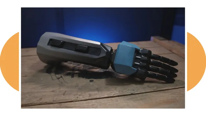 bionic arm